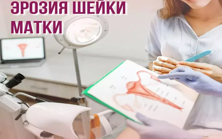 Эрозия шейки матки