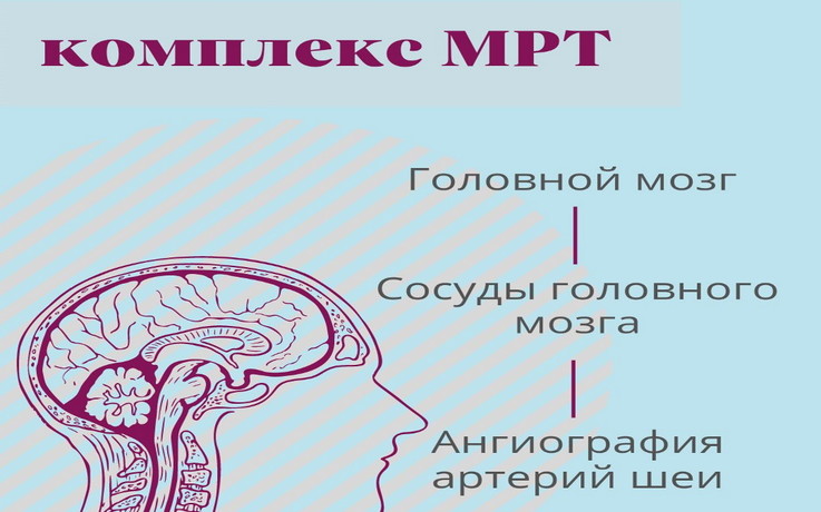 МРТ Головной мозг, сосуды головного мозга, ангиография артерий шеи
