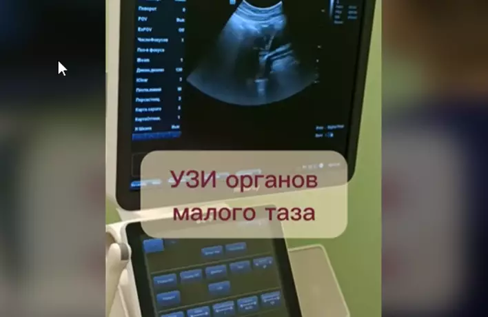 УЗИ органов малого таза