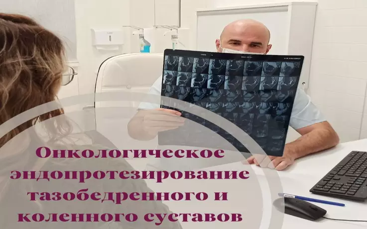 ОНКОЛОГИЧЕСКОЕ ЭНДОПРОТЕЗИРОВАНИЕ ТАЗОБЕДРЕННОГО И КОЛЕННОГО СУСТАВОВ