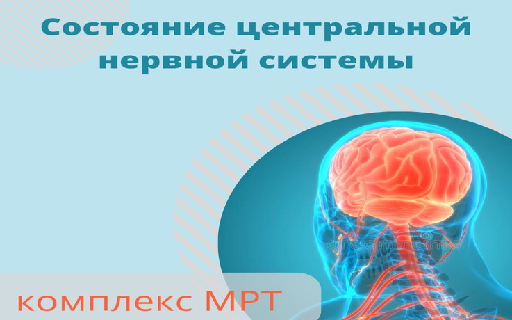 Комплекс МРТ «Состояние центральной нервной системы»