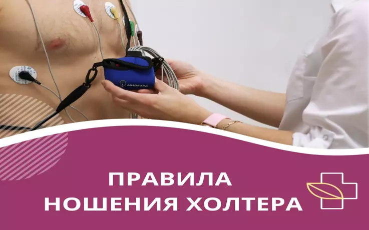 Правила ношения холтера