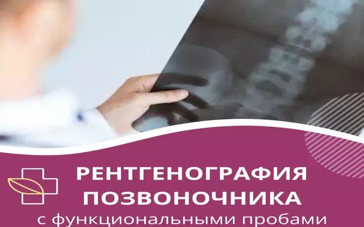 Рентгенография позвоночника с функциональными пробами.